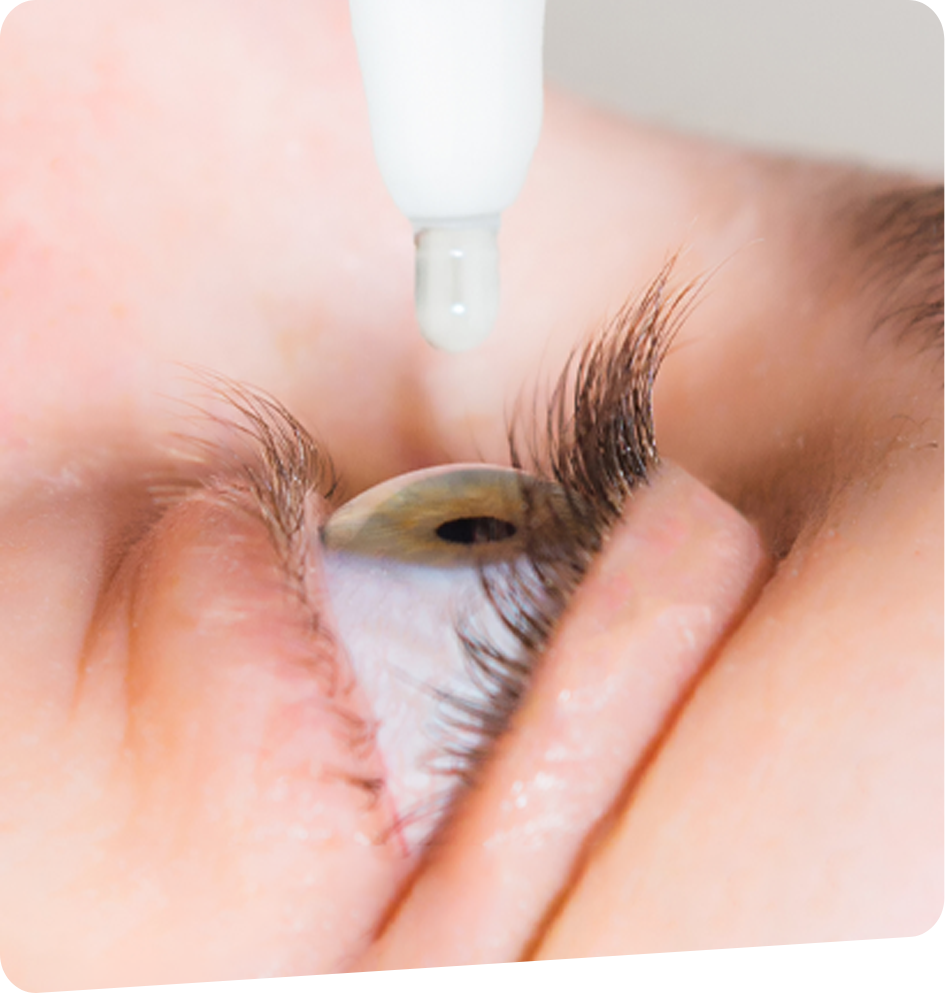 Oeil-sec-foch-vision-bayonne-tarnos-capbreton-dax-2