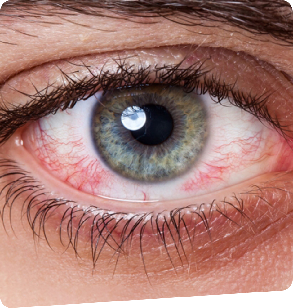 oncologie-foch-vision-bayonne-tarnos-capbreton-dax-2